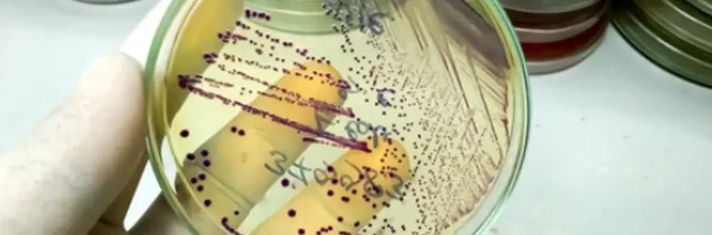 Understanding Total Coliform and E. coli Testing – Why It’s Essential for Safe Drinking Water